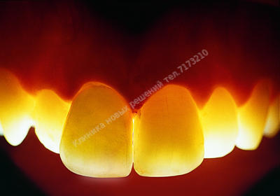 Lava технология в стоматологии